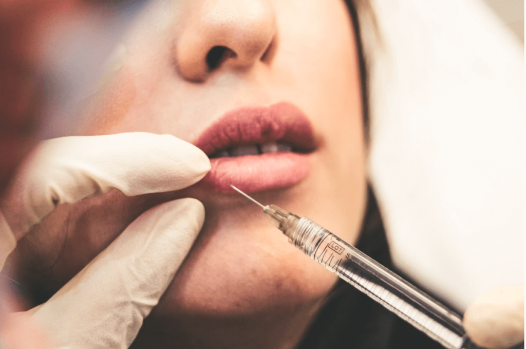 All That You Need To Know About The Russian Lips Procedure And Technique